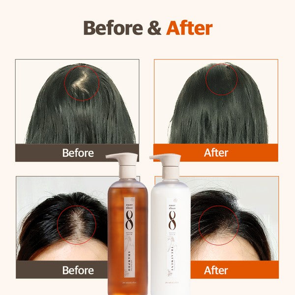 Matsutake Stem Cell Shampoo & Conditioner Set - Premium Shampoo from Morethan8 - Just $75! Shop now at Ida Louise Boutique